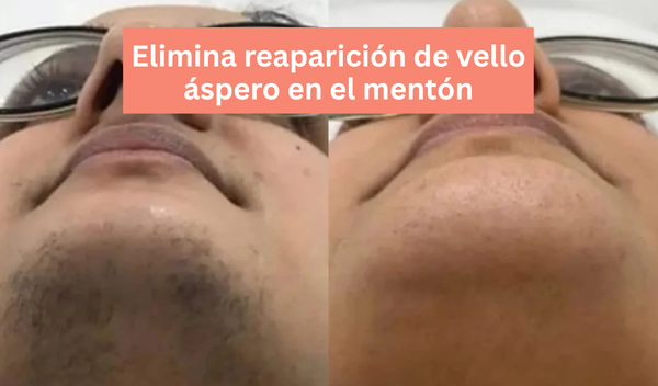 Aceite Reductor de Vello